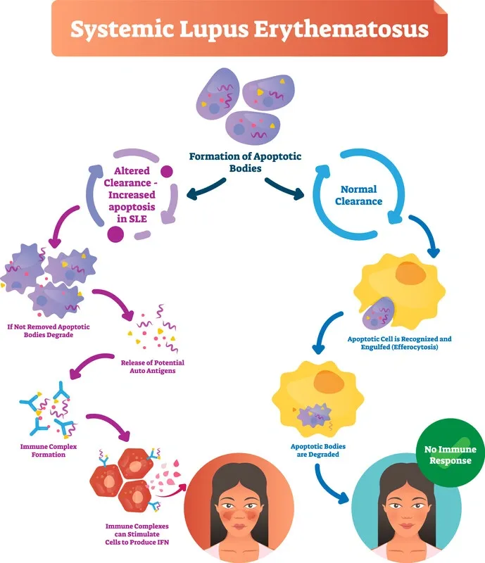 “Unraveling the Mystery: Deepening Our Grasp on Lupus and Its Impact” - United Together Lupus Foundation, Saginaw MI (photo 8)